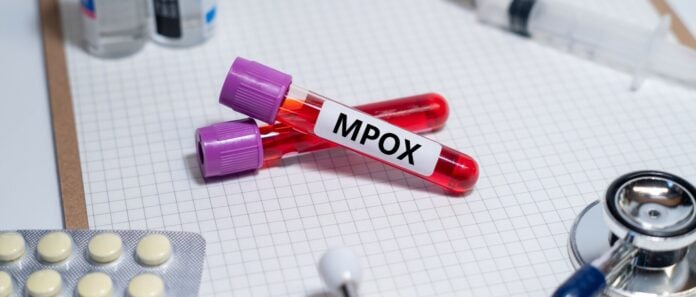 Επιδημία mpox στην Αφρική με αυξανόμενο αριθμό κρουσμάτων και θανάτων